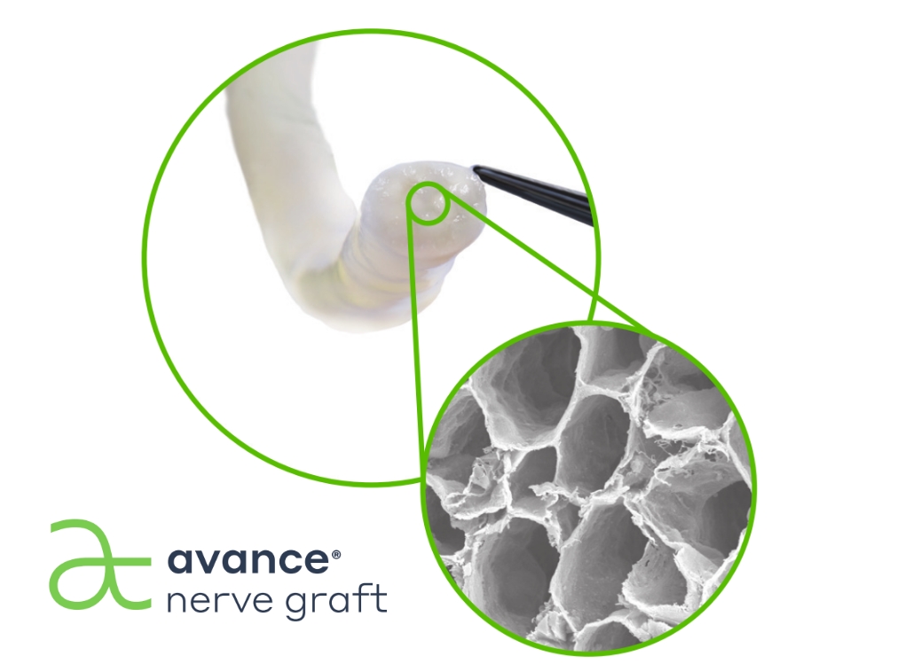 Avance® Nerve Graft logo and a photo of a biologically active, laminin-rich endoneurial tube with a close-up image showing a microscopic view of native nerve micro-acrhitecture