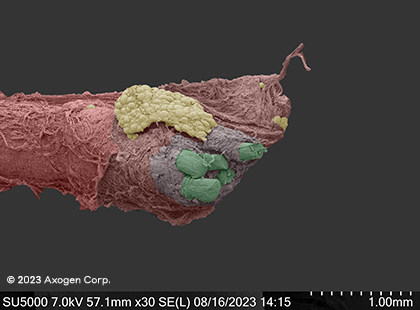 Microscope image of a nerve cut by kitchen knife, showing a rough cut