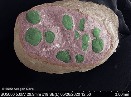 Microscope image of a nerve cut by a surgical blade, showing a clean cut