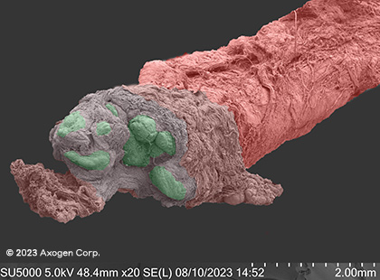 Microscope image of a nerve cut by glass, showing a rough cut