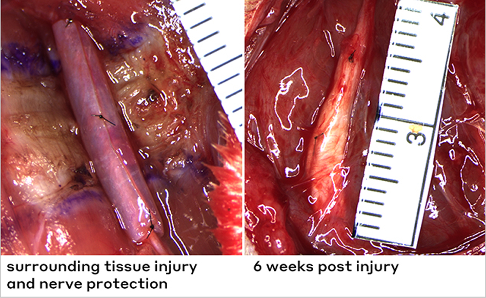 Surgical photo of a wrapped nerve with caption “surrounding tissue injury and nerve protection” alongside photo of healed tissue bed with caption “6 weeks post injury”