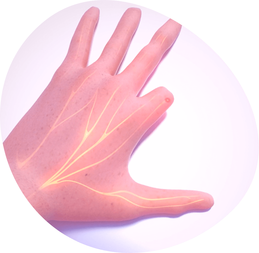 Video thumbnail: Axoguard Nerve Cap animation