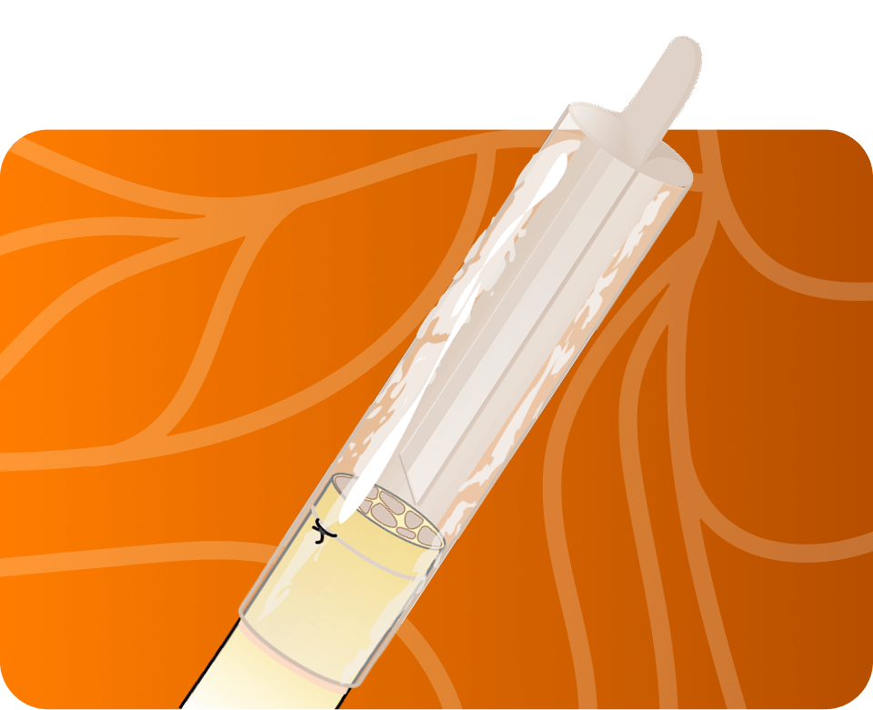 Axoguard Nerve Cap proprietary bifurcation