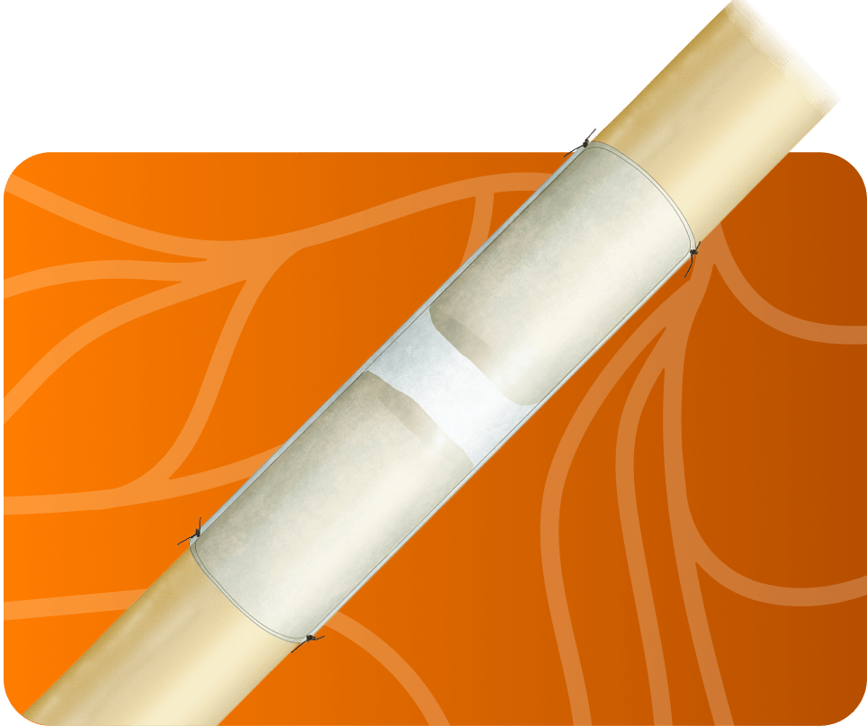 Product image of Axoguard Nerve Connector 3D scaffold