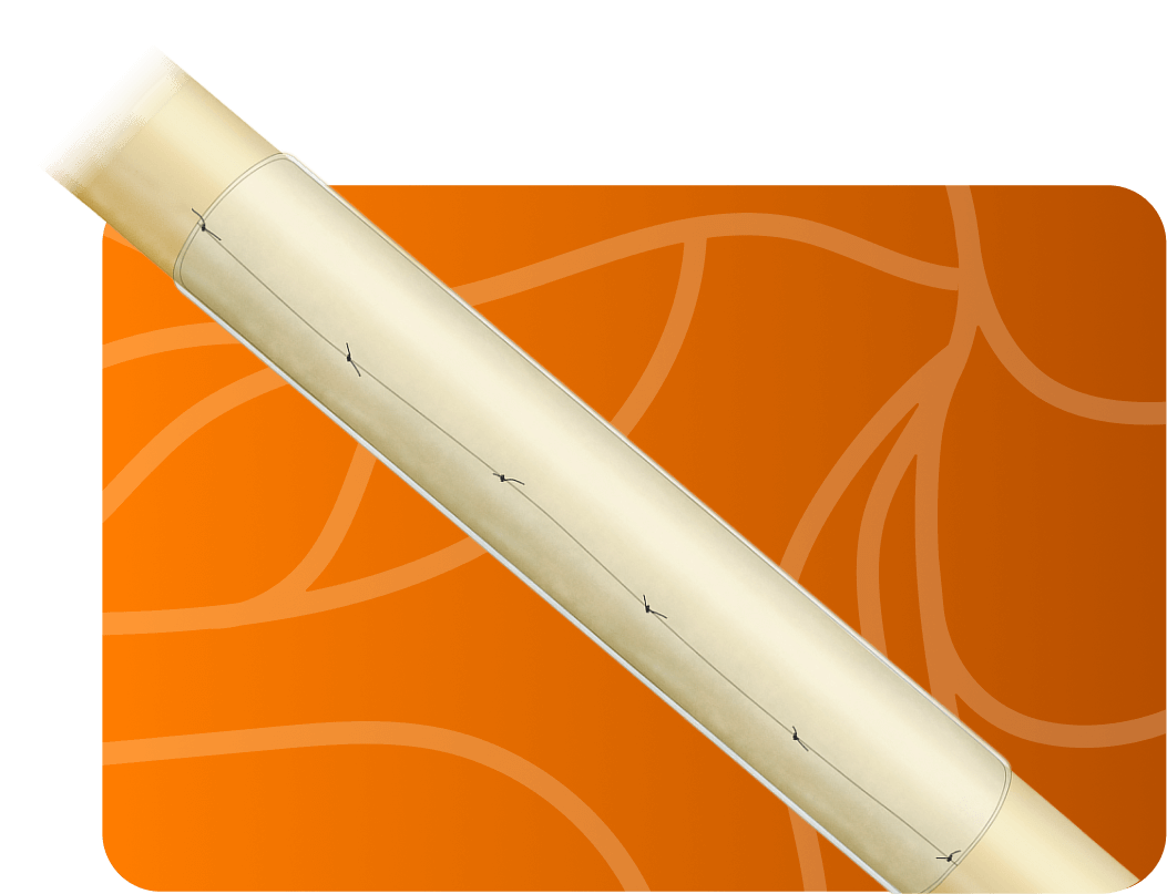 Axoguard Nerve Protector applied to a damaged nerve